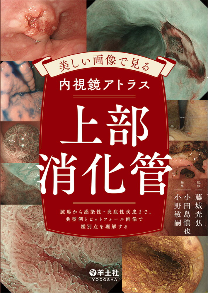 Ǹȥ饹ò[ƣ]