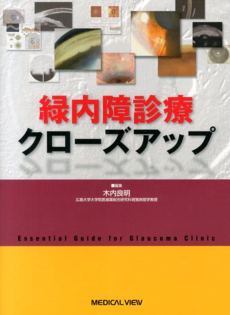 楽天ブックス: 緑内障診療クローズアップ - 木内良明 - 9784758310888 : 本