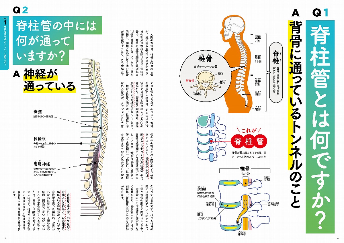 名医に聞く!脊柱管狭窄症がラクになる100問100答（TJMOOK）