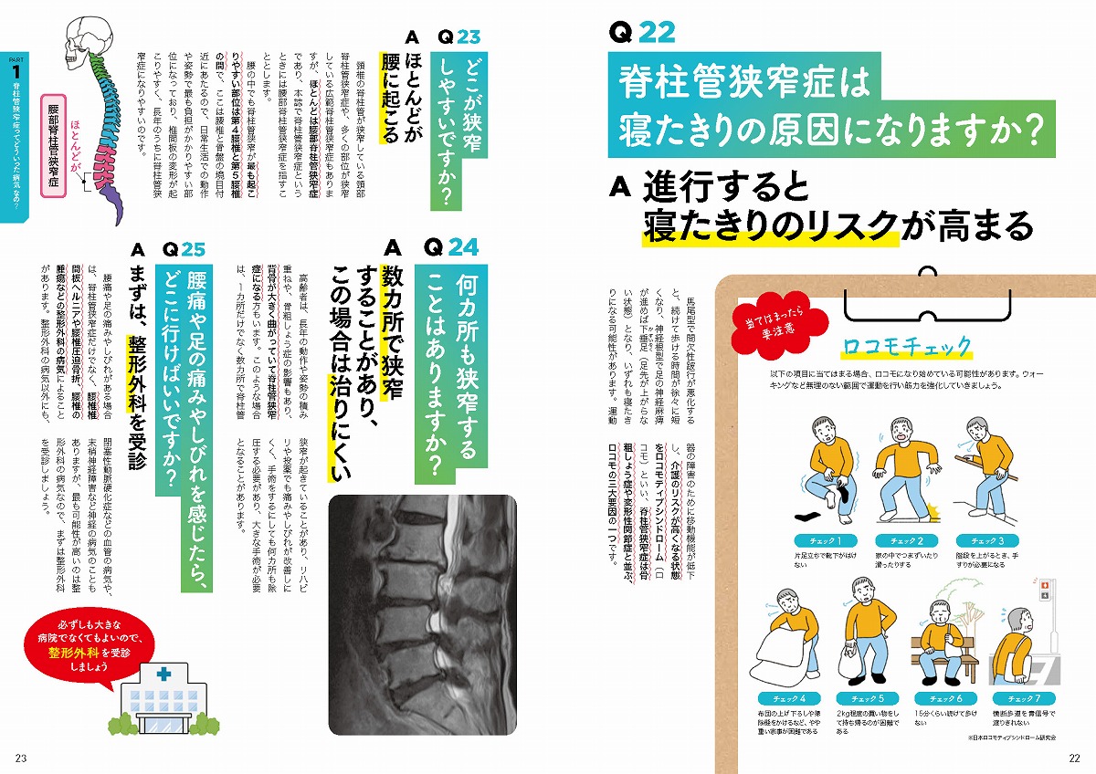 名医に聞く!脊柱管狭窄症がラクになる100問100答（TJMOOK）