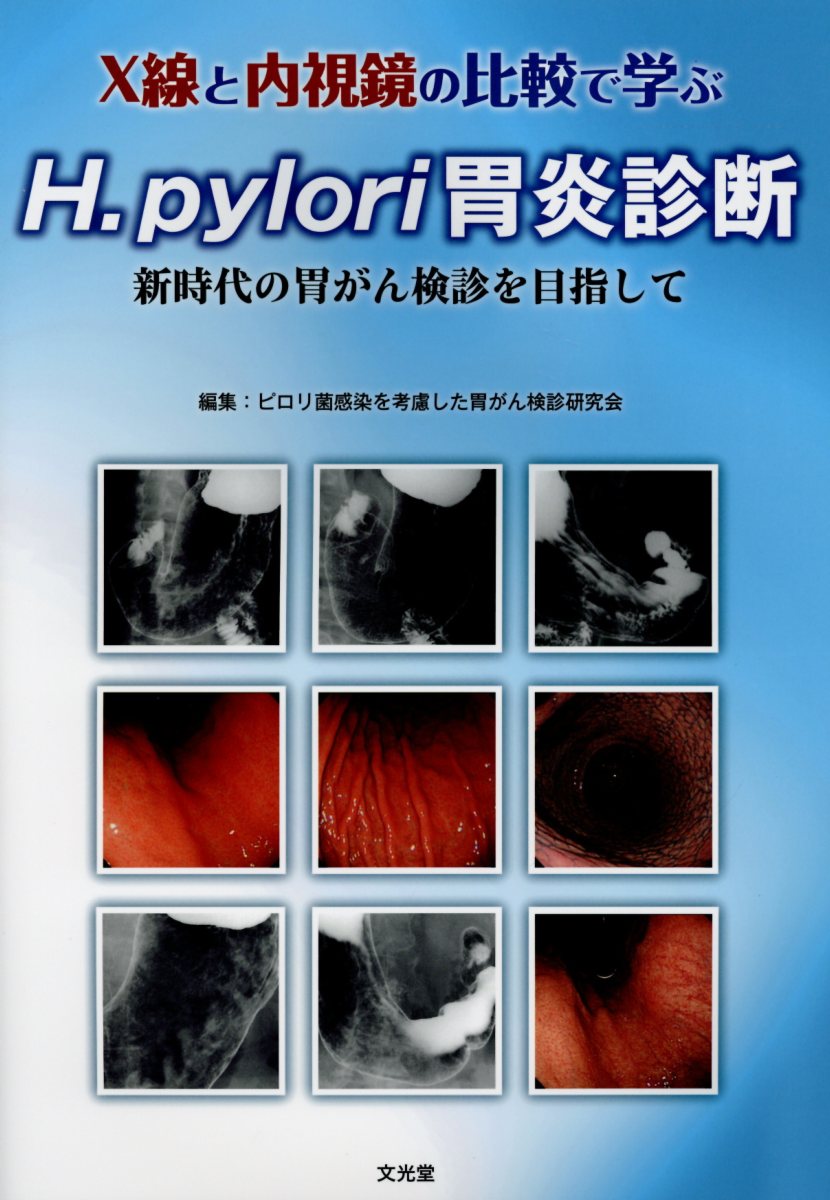 楽天ブックス: X線と内視鏡の比較で学ぶH．pylori胃炎診断 - 新