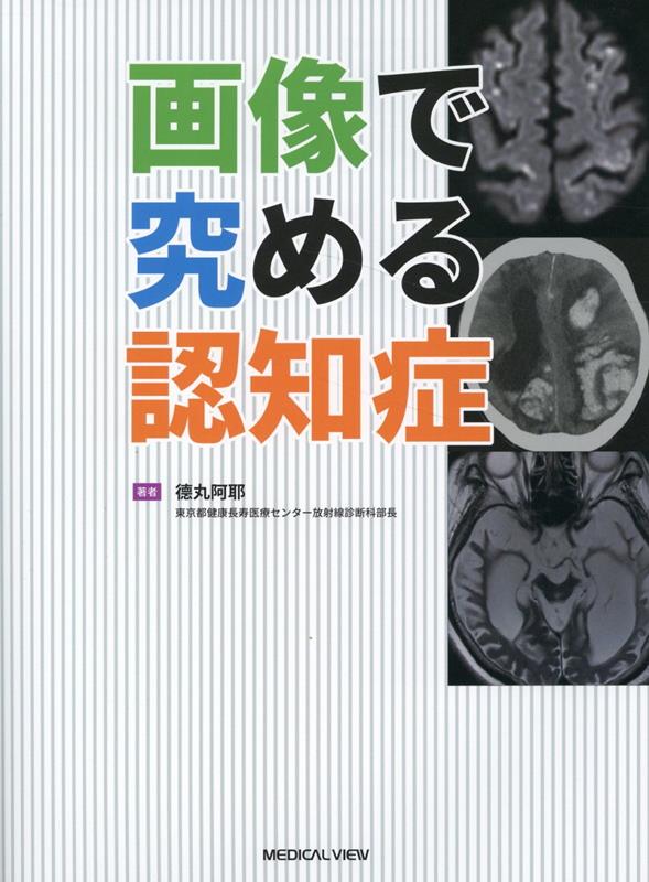 楽天ブックス: 画像で究める認知症診断 - 徳丸 阿耶