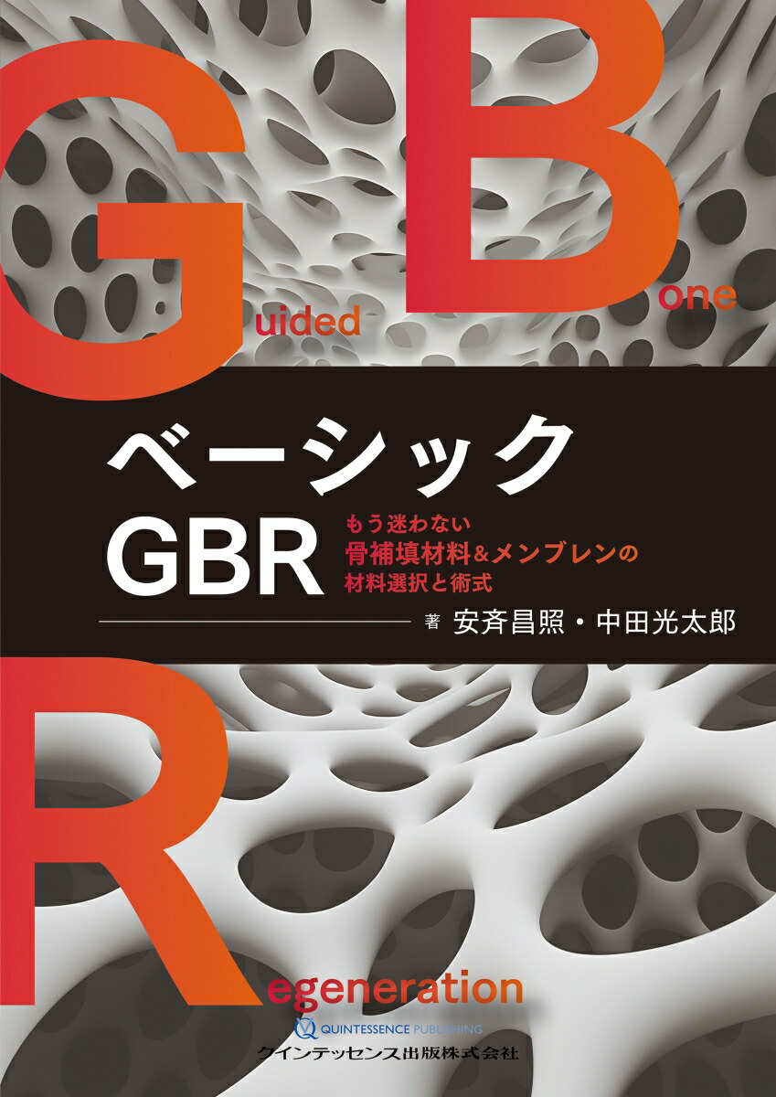 楽天ブックス: ベーシックGBR - もう迷わない骨補填材料
