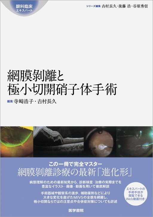 網膜剥離と極小切開硝子体手術 医学書院 楽天ブックス: 網膜剥離と極小切開硝子体手術 - 寺崎 浩子