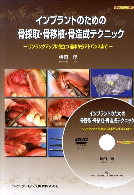 楽天ブックス: インプラントのための骨採取・骨移植・骨造成テクニック