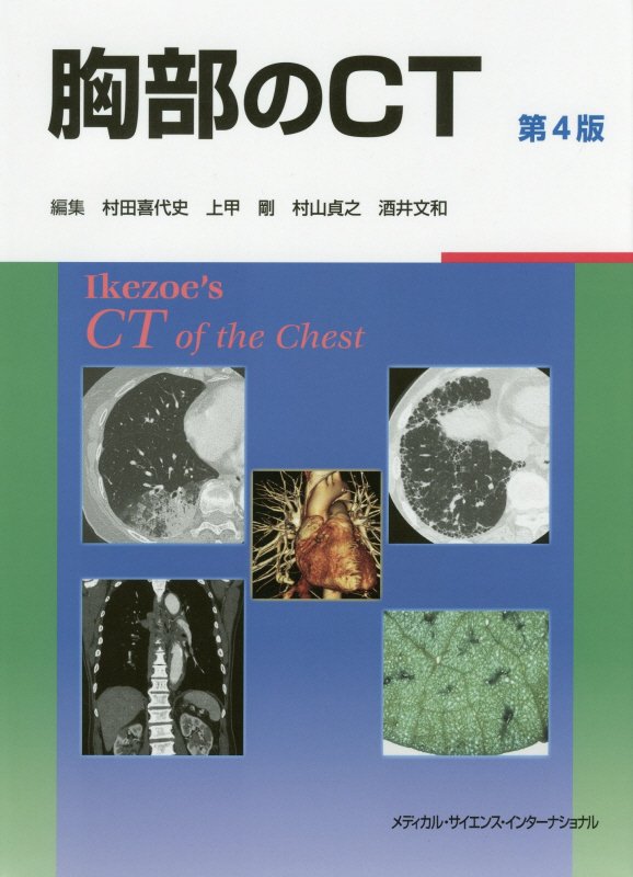 楽天ブックス: 胸部のCT - 村田 喜代史 - 9784815701185 : 本