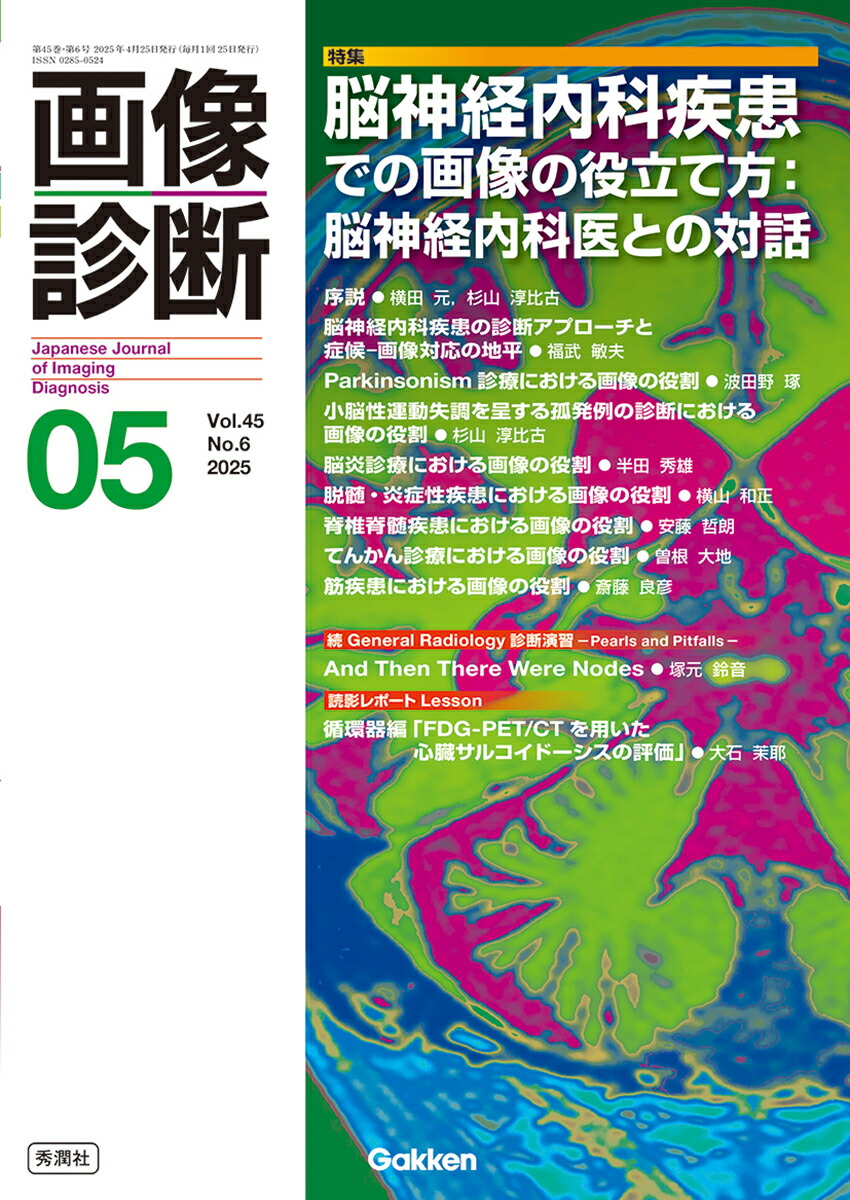 定率割引 往復 楽天ブックス: 画像診断2025年5月号 Vol．45 No．6 - 脳神経内科 医学一般