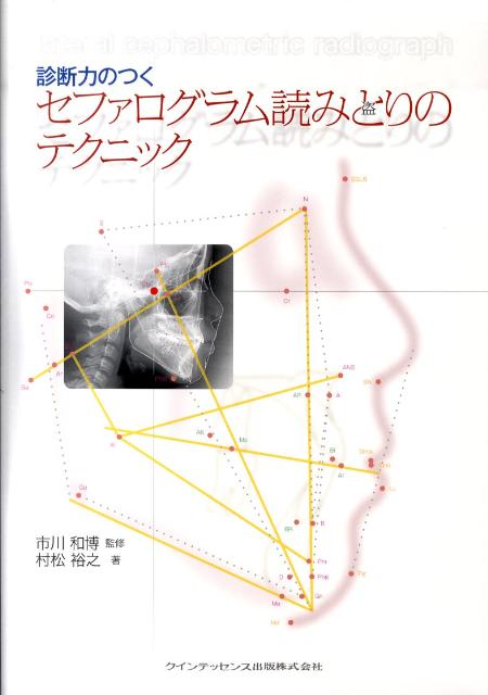 楽天ブックス: 診断力のつくセファログラム読みとりのテクニック