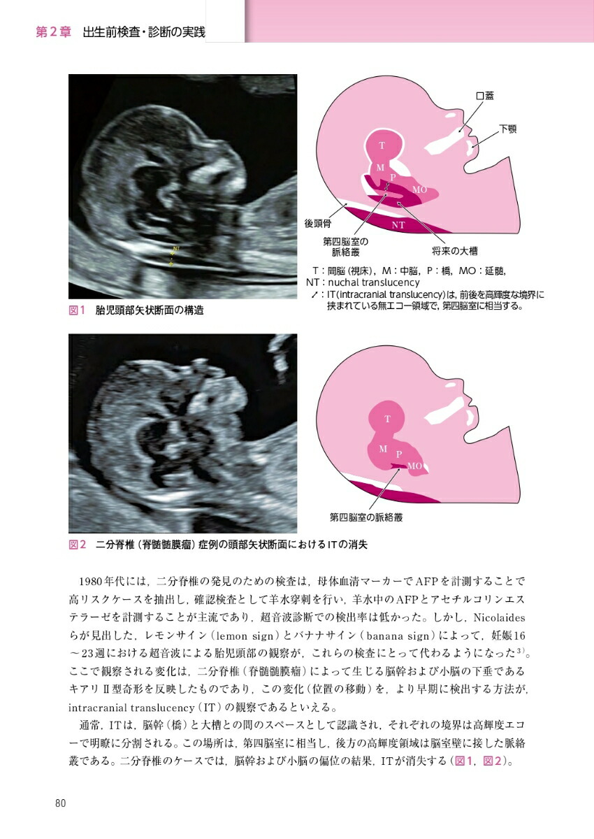 FMCテキストブック出生前検査・診断と遺伝カウンセリングの実際[中村靖]