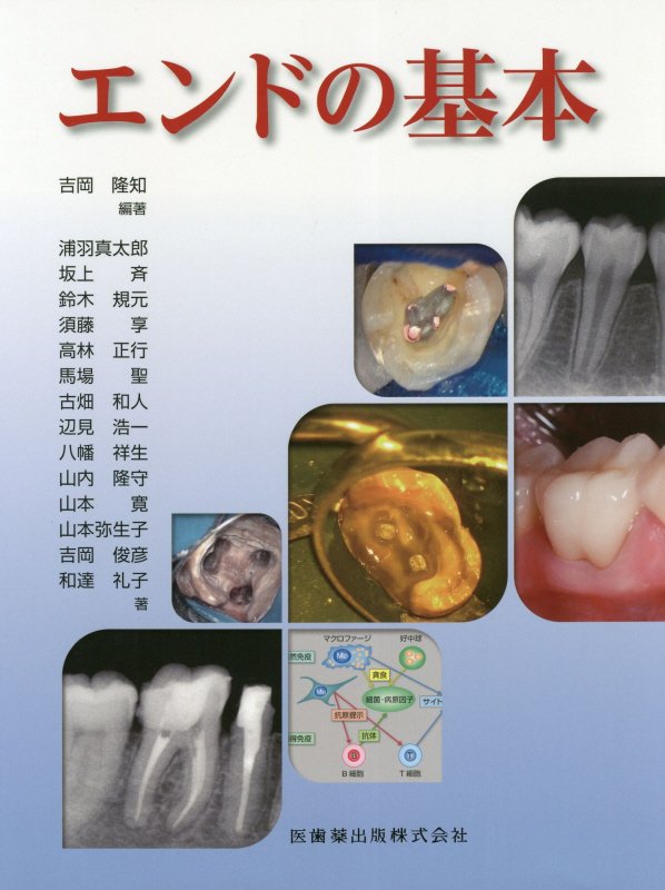 楽天ブックス: エンドの基本 - 吉岡隆知 - 9784263461457 : 本