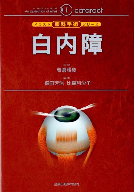 価格が安い 網膜硝子体手術 イラスト眼科手術シリーズ 6 単行本 国内店舗正規品 Pnlp Sn