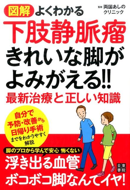 楽天ブックス: 図解 よくわかる下肢静脈瘤 きれいな足がよみがえる