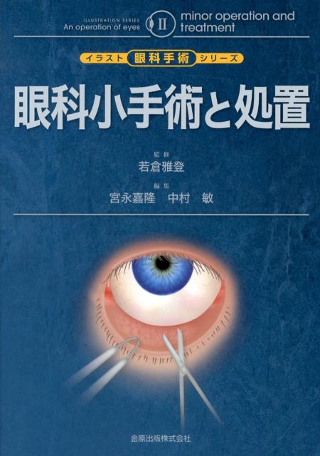 期間限定割引 眼科小手術と処置 イラスト眼科手術シリーズ 郵送送料無料 科学 医学 技術本 雑誌 コミック Www Tripseller In