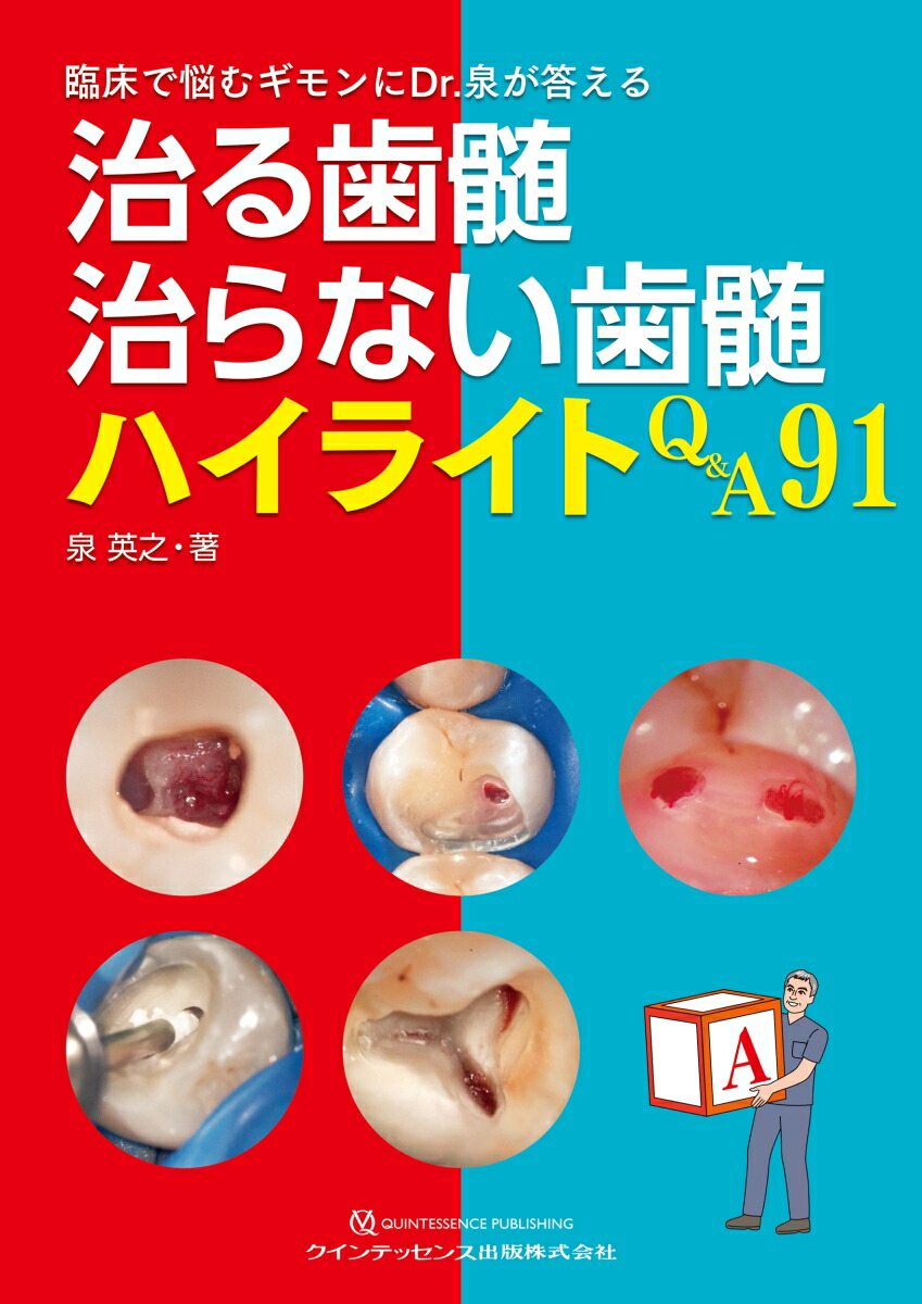 楽天市場】治る歯髄 治らない歯髄 ハイライトQ & A91 臨床で悩む