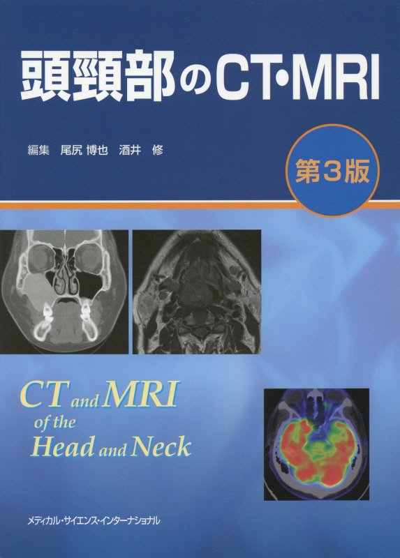 楽天ブックス: 頭頸部のCT・MRI - 尾尻 博也 - 9784815701574 : 本