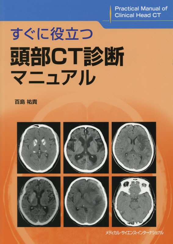 楽天ブックス: すぐに役立つ頭部CT診断マニュアル - 百島 祐貴