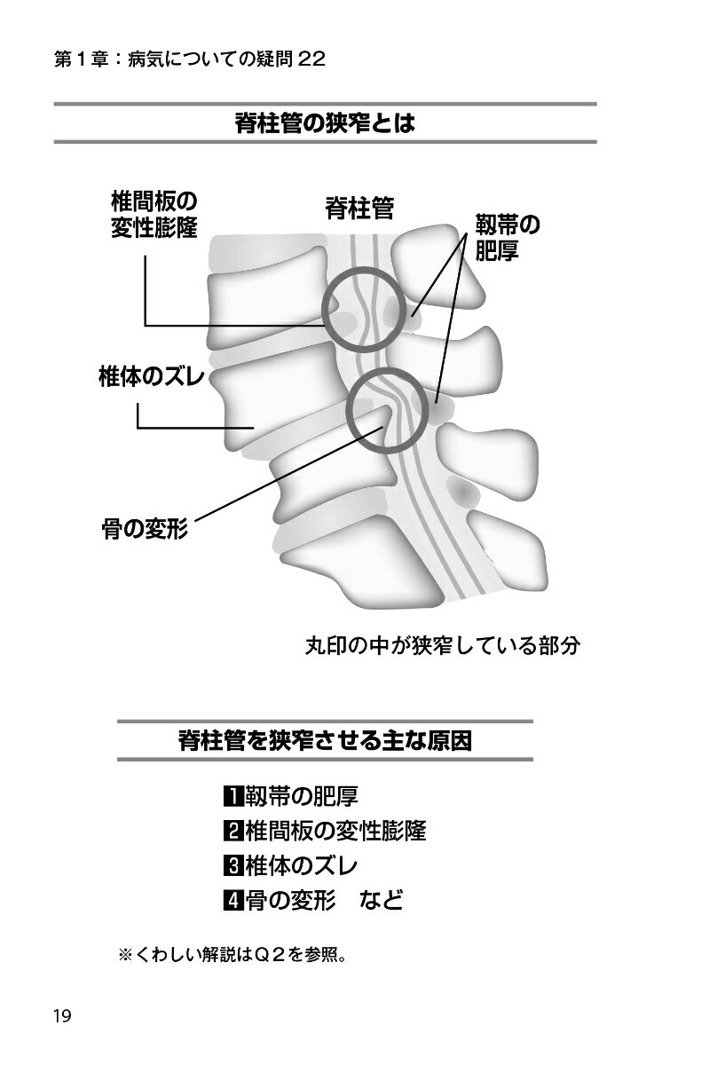 ����ɶ����ɹ���̾��20�ͤ�������ǹ�μ���������ʹ�������Ƥ�ʹ���ʤ��ä�150�������夬�ܲ��ǲ������ʷ򹯼��ѡ�[���Ͽð�ۤ�]