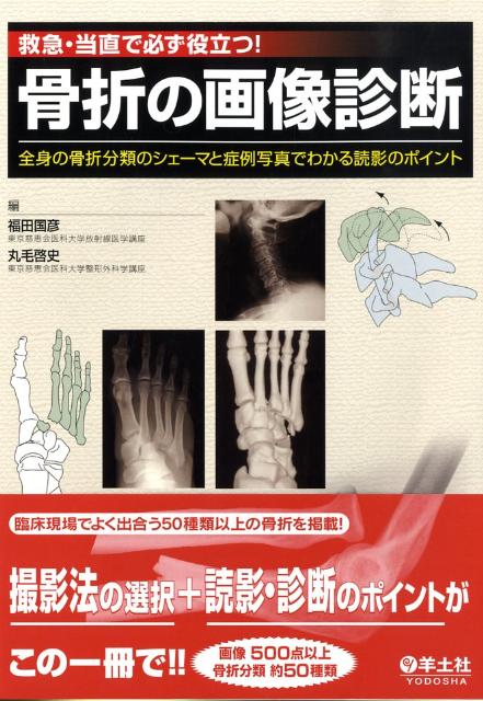 救急・当直で必ず役立つ！骨折の画像診断　全身の骨折分類のシェーマと症例写真でわかる読影のポ