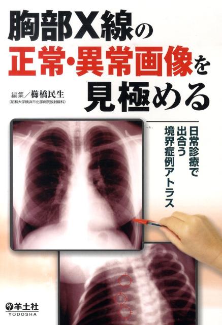 楽天ブックス: 胸部X線の正常・異常画像を見極める - 日常診療で出合う