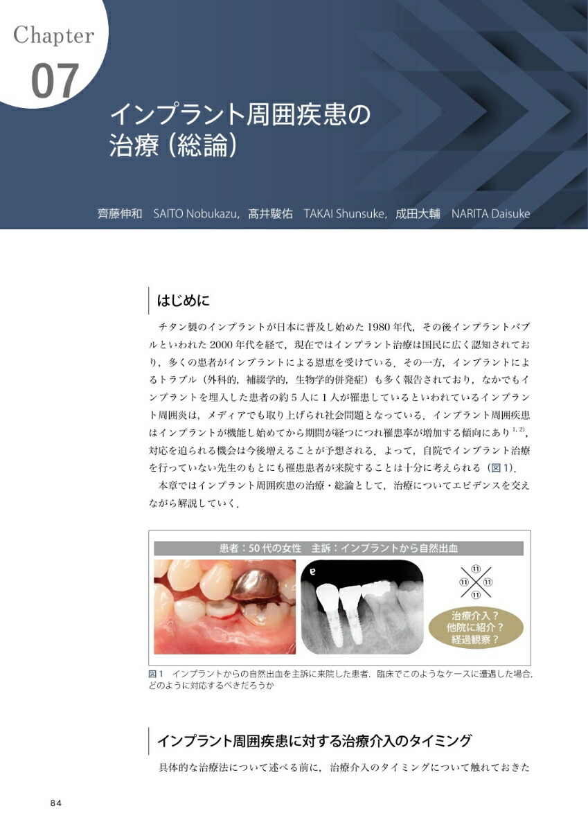 楽天ブックス インプラント周囲疾患のすべて Textbook of PeriImplant Disease 鈴木 秀典