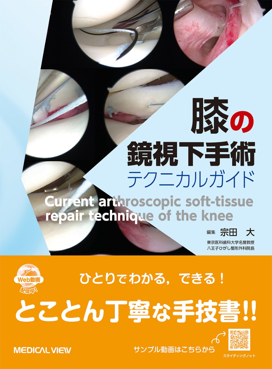 人工膝関節置換術「TKA」のすべて : 安全・確実な手術のために - 健康/