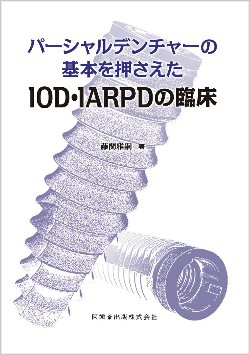 パーシャルデンチャーの基本を押さえたIOD・IARPDの臨床画像