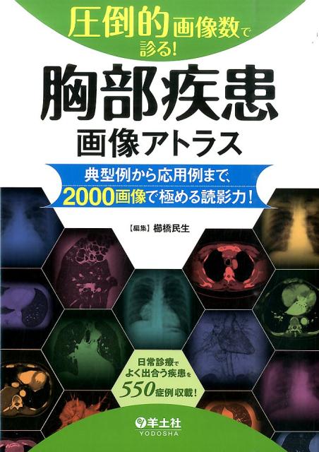 圧倒的画像数で診る! 腹部疾患画像アトラス―典型例から応用例まで、2000画像で極める読影力! 圧倒的画像数で診る！ 腹部疾患画像アトラス〜典型例から応用例