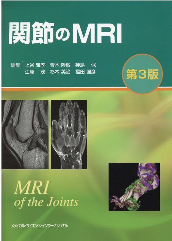 楽天ブックス: 関節のMRI - 上谷 雅孝 - 9784815701871 : 本