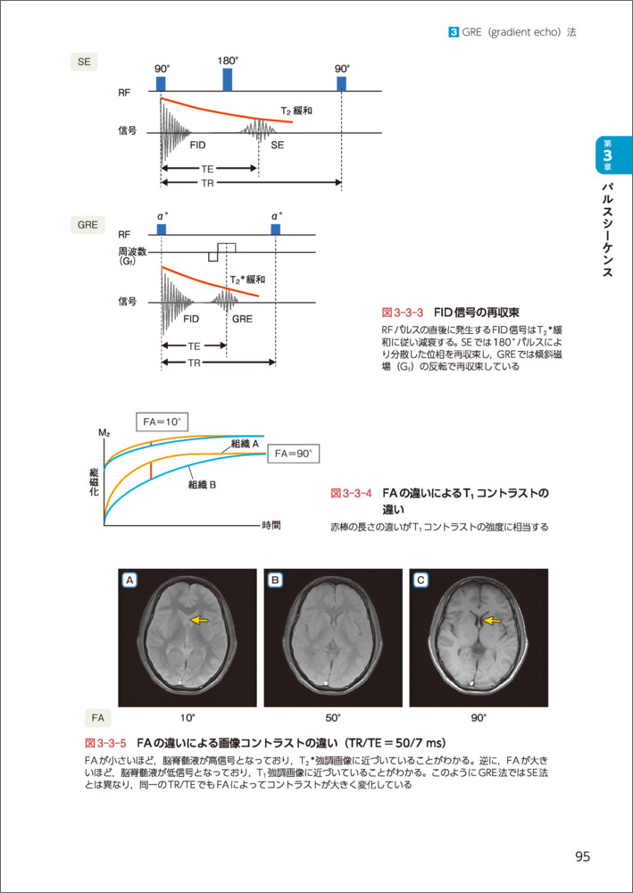 ビジュアル放射線科学MRI撮像技術[郡倫一]
