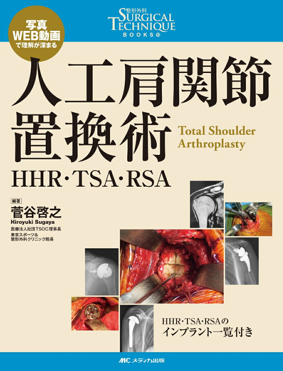 楽天ブックス: 人工肩関節置換術 - HHR・TSA・RSA - 菅谷 啓之 