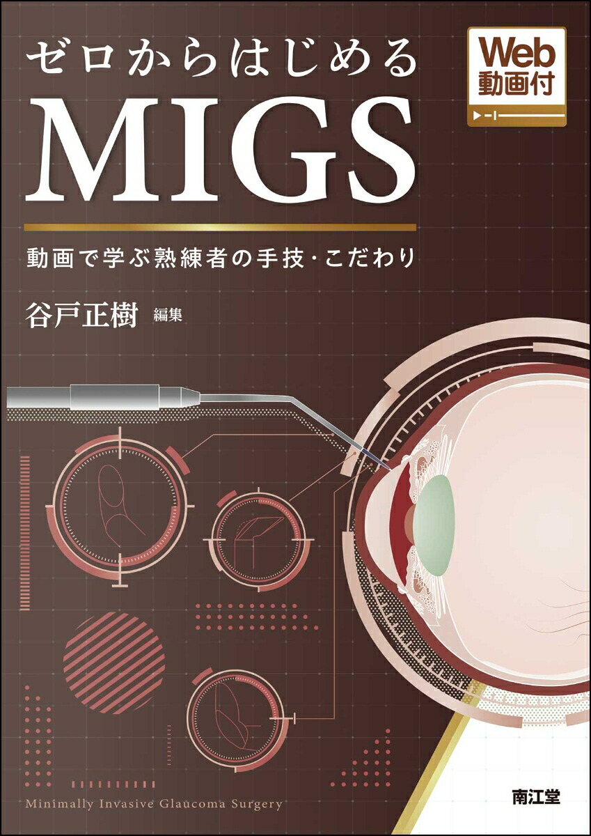 楽天ブックス: ゼロからはじめるMIGS［Web動画付］ - 動画で学ぶ熟練者