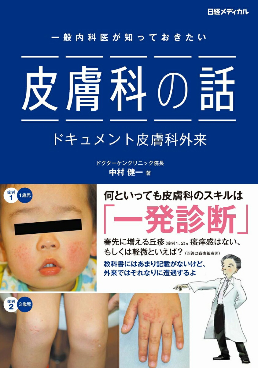 楽天ブックス: 一般内科医が知っておきたい 皮膚科の話 - ドキュメント