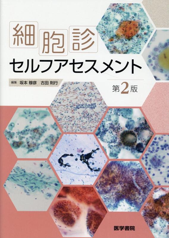 楽天ブックス: 細胞診セルフアセスメント 第2版 - 坂本 穆彦