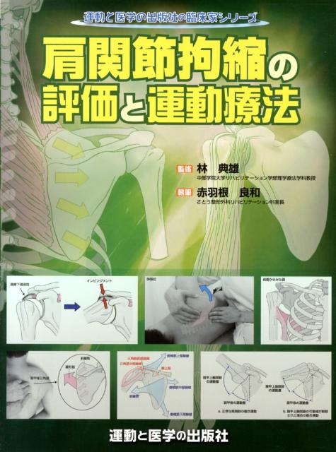 肩関節拘縮の評価と運動療法／林典雄／赤羽根良和 - 科学・医学・技術