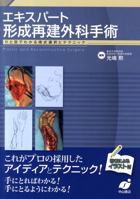 楽天ブックス: エキスパート形成再建外科手術 - ひと目でわかる