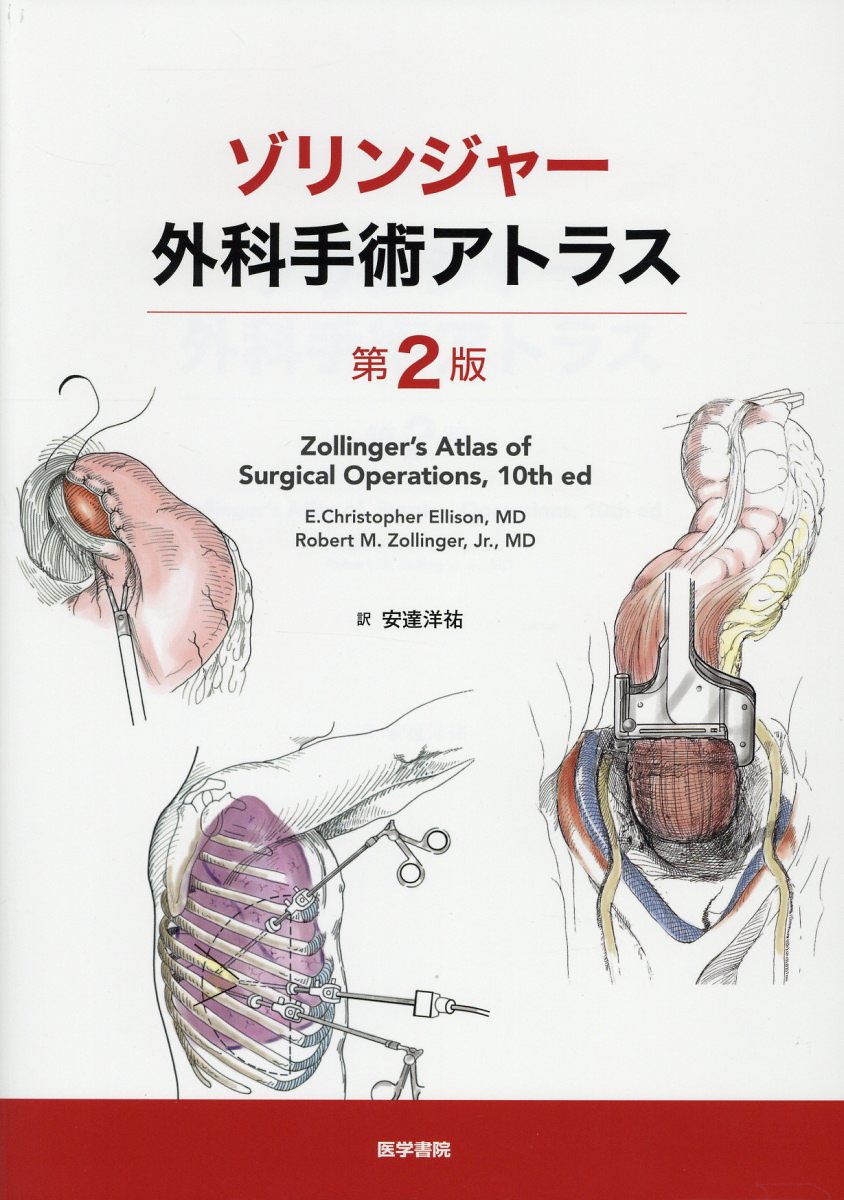 楽天ブックス: ゾリンジャー外科手術アトラス 第2版 - 安達 洋祐