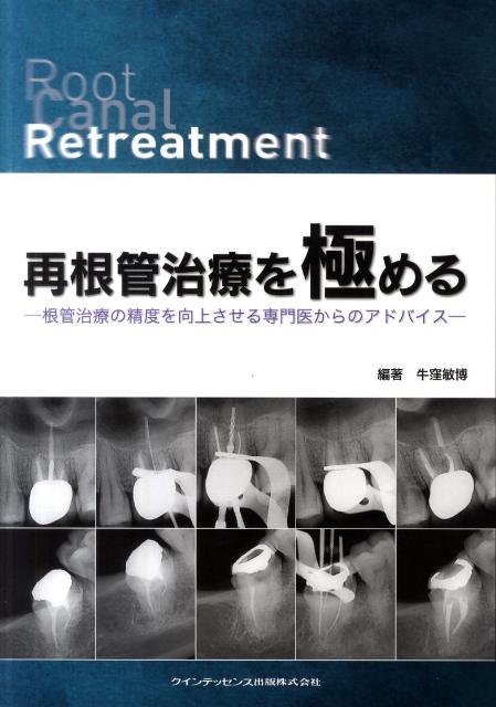 楽天ブックス: 再根管治療を極める - 根管治療の精度を向上