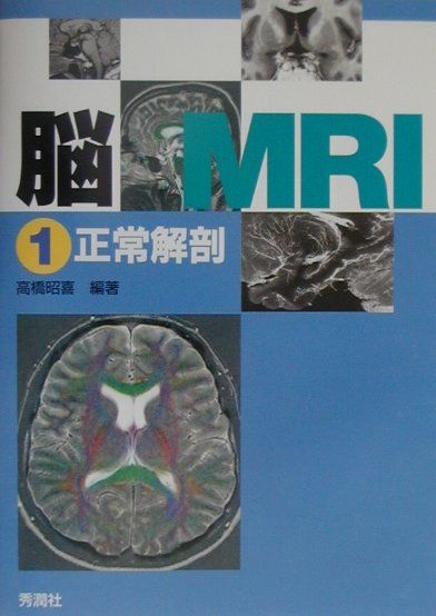 脳MRI（1）　正常解剖