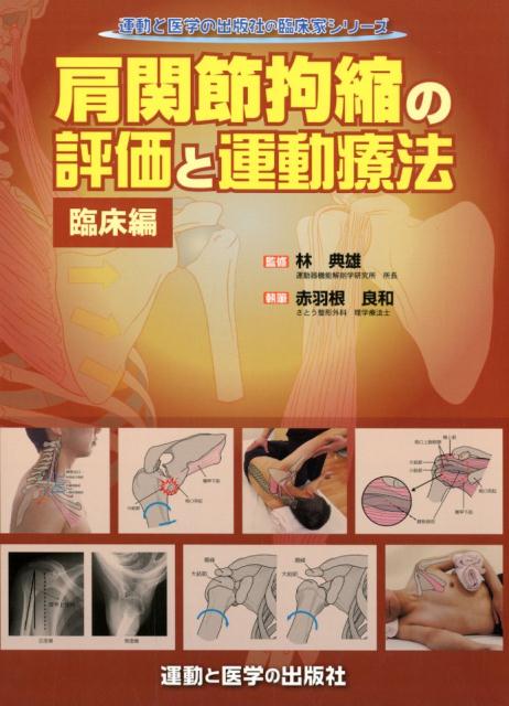 楽天ブックス: 肩関節拘縮の評価と運動療法 臨床編 - 林典雄 