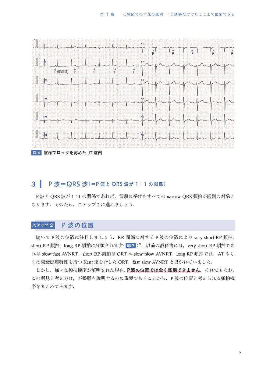 EPSとSVT心臓電気生理学的検査と上室頻拍[永嶋孝一]