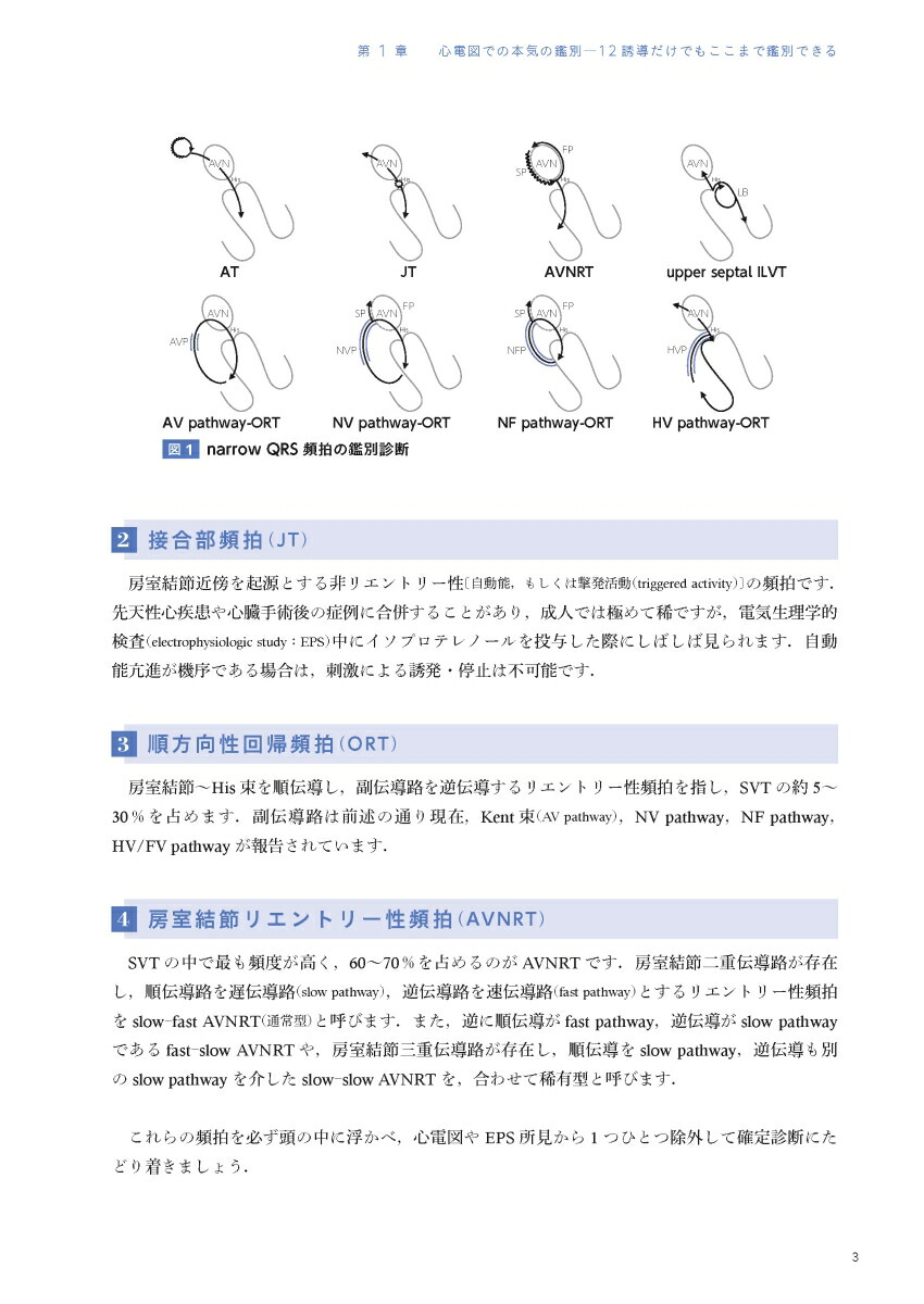 EPSとSVT心臓電気生理学的検査と上室頻拍[永嶋孝一]