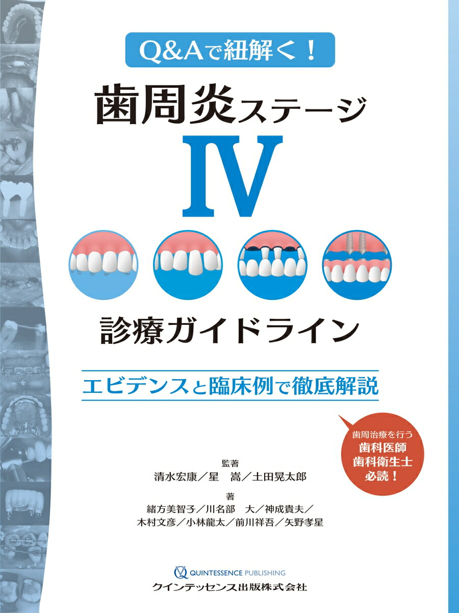 楽天ブックス: 歯周炎ステージ4診療ガイドライン - エビデンスと臨床例