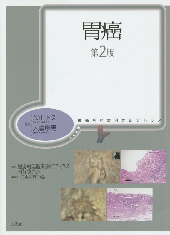 93％以上節約 腫瘍病理鑑別診断アトラス 悪性軟部腫瘍 改訂 改題第2版