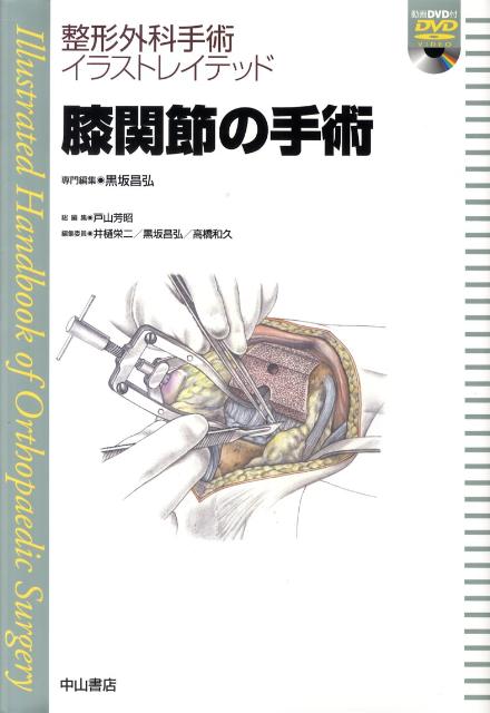 新しい到着 膝関節の手術 整形外科手術イラストレイテッド 新品即決 Www Nationalmuseum Gov Ph