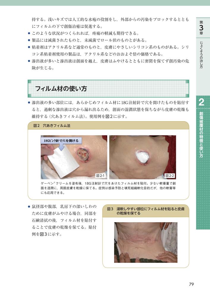 じょくそうケアナビ在宅・介護施設における対策実践ガイド[日本褥瘡学会・在宅ケア推進協会]