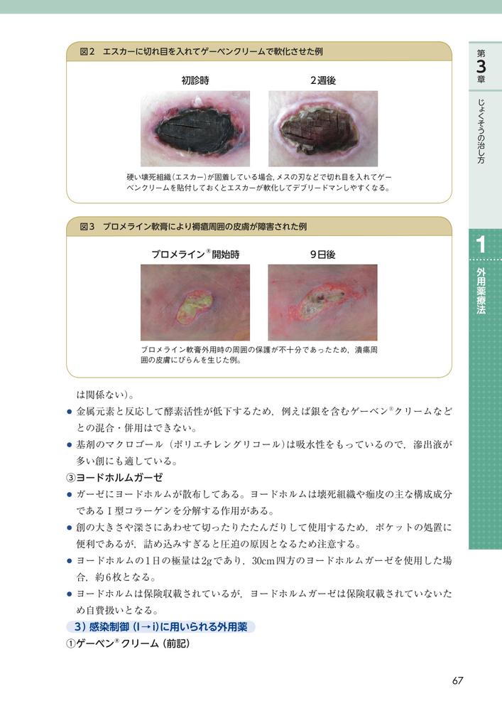じょくそうケアナビ在宅・介護施設における対策実践ガイド[日本褥瘡学会・在宅ケア推進協会]