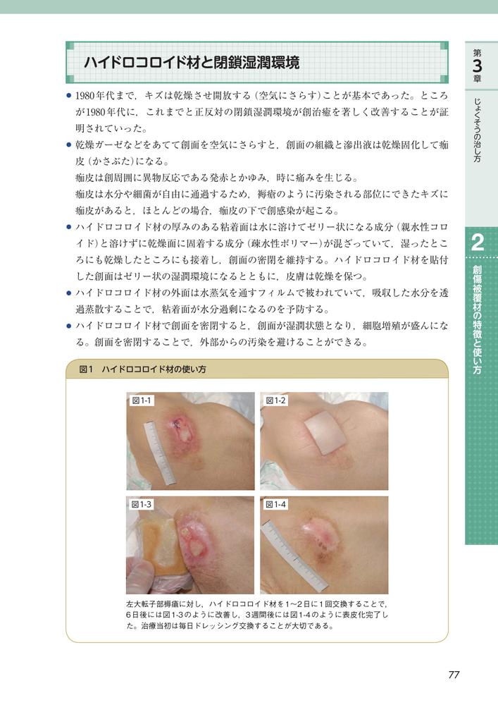 じょくそうケアナビ在宅・介護施設における対策実践ガイド[日本褥瘡学会・在宅ケア推進協会]