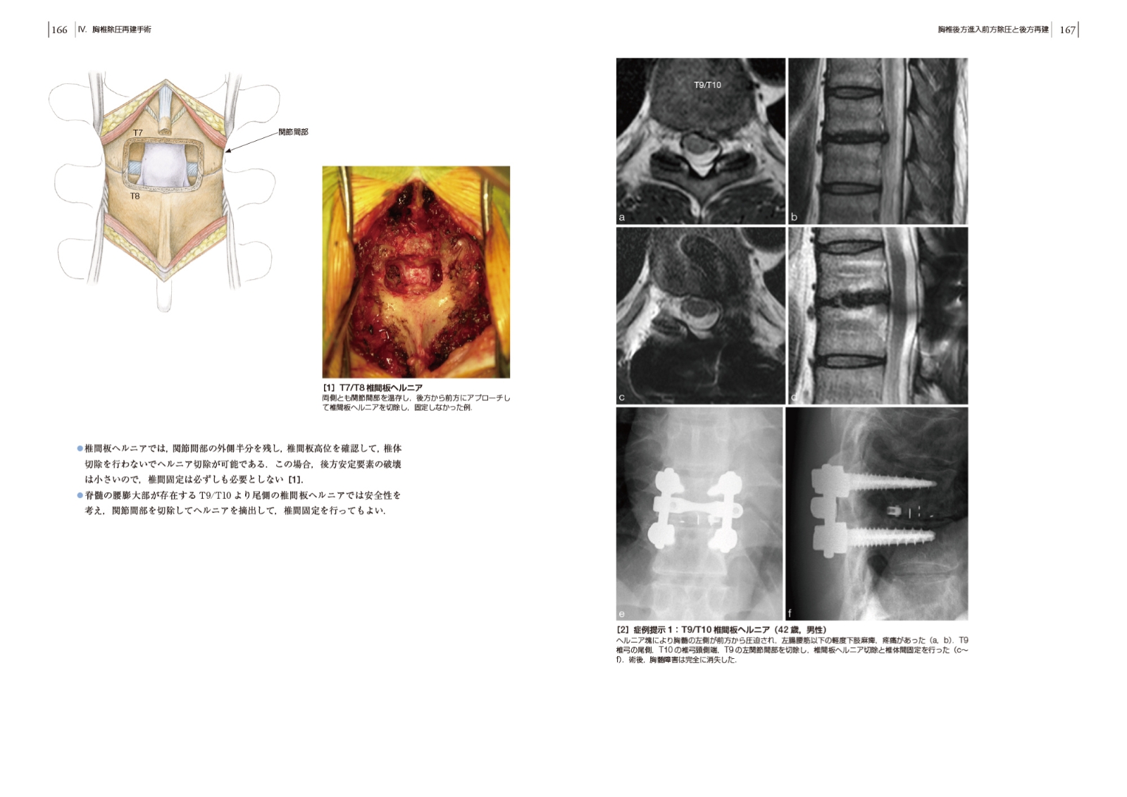 楽天ブックス 頚椎 胸椎の手術 Dvd付 鐙 邦芳 本