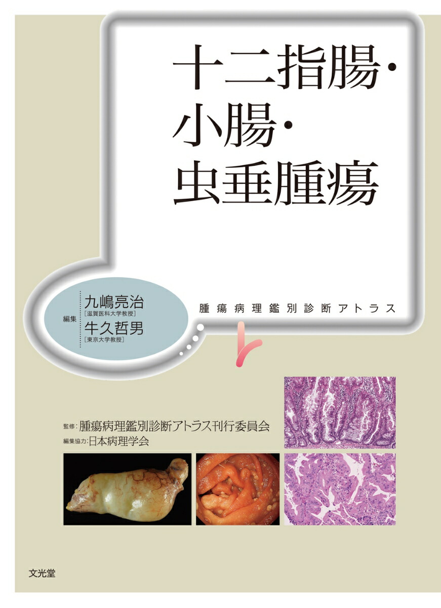 胃・十二指腸潰瘍とは | 原因・症状・予防・治療法を解説 | ヨミ
