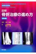 図解骨折治療の進め方 3版 図解 骨折治療の進め方 第3版 | 書籍詳細 | 書籍 | 医学書院